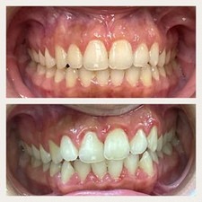 Odontología (Resultados)