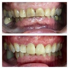 Odontología (Resultados)