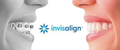 OdontologÃ­a (Invisalign)